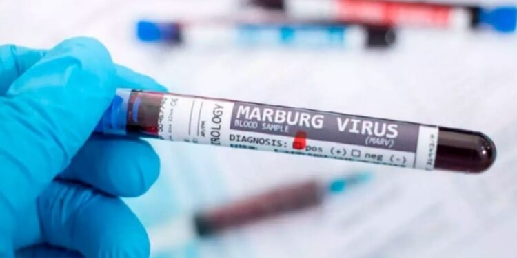 OMS en alerta por nuevos casos del virus Marburgo, estos son los síntomas