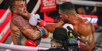 Jake Paul sale de cirugía de mandíbula tras pelea con Anthony Joshua