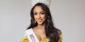 Empeora el estado de salud de Miss Jamaica, será trasladada a su país