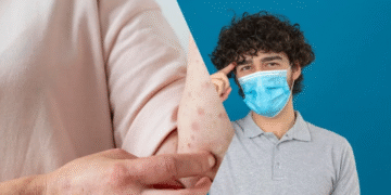 Jalisco ordena el uso obligatorio de cubrebocas en escuelas ante el brote de sarampión