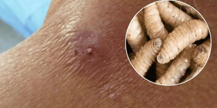 Reportan en Yucatán primera muerte humana asociada a miasis por gusano barrenador
