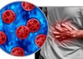 Investigan posibles casos de ciclosporiasis vinculados a Quintana Roo