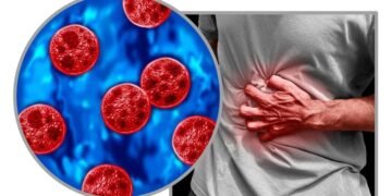 Investigan posibles casos de ciclosporiasis vinculados a Quintana Roo